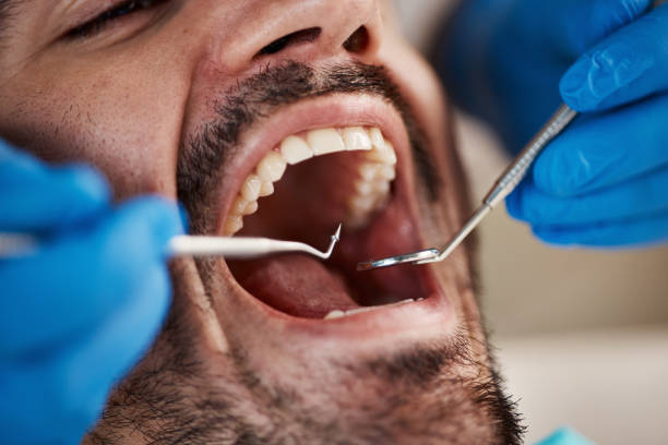Best Emergency Tooth Extraction  in Metropolis, IL