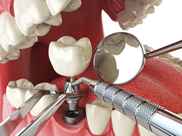 Professional Emergency Dentist in IL